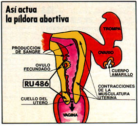 Abortar en Guipúzcoa