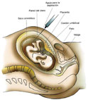 Obstetricia