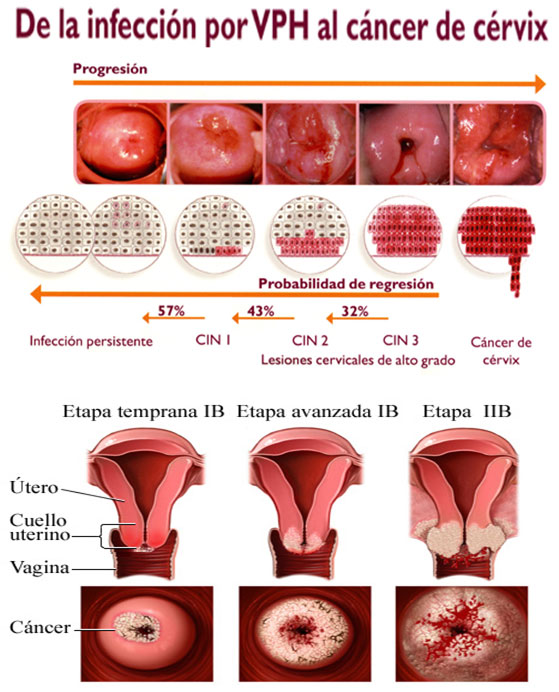 Ginecología