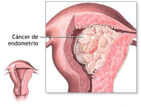 Ginecología