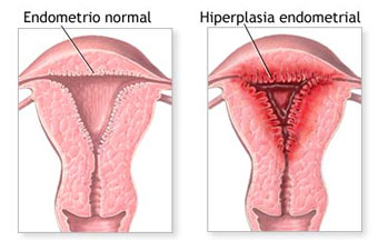 Ginecología