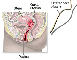 Ginecología