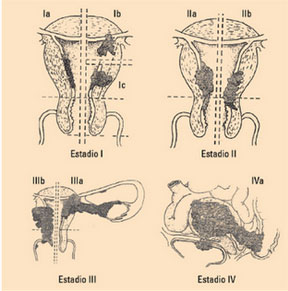 Ginecología