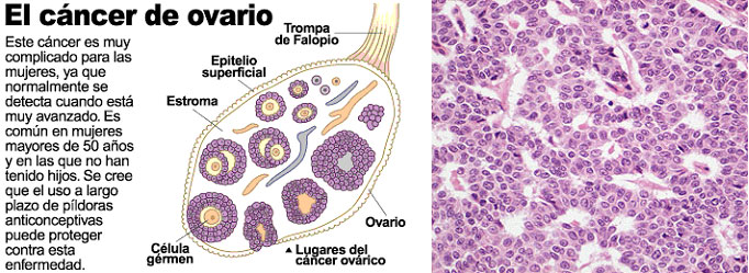 Ginecología