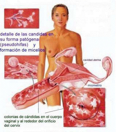 enfermedades-de-transmision-sexual