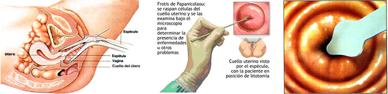 Citología