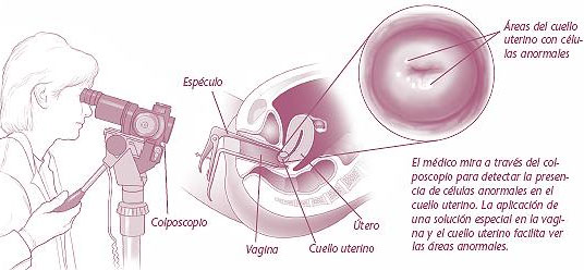 Abortar en Guipúzcoa