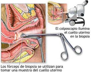 Abortar en Guipúzcoa