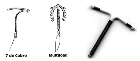 metodos-anticonceptivos