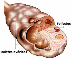 Ginecología