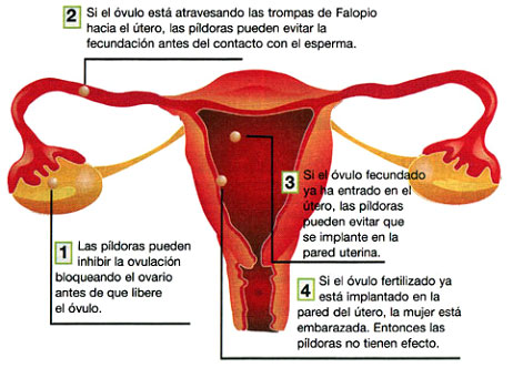 metodos-anticonceptivos