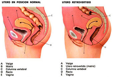 Ginecología