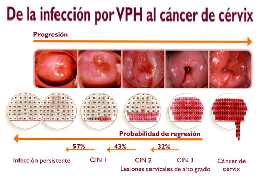 virus del papiloma fases)